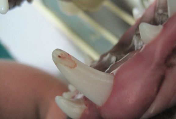 Переломы зубов: лечить или нет?